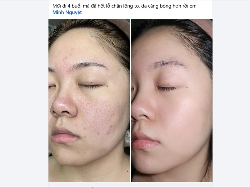 Một bài chạy ads đơn giản